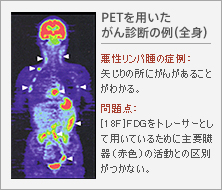 PET��p��������f�f�̗�