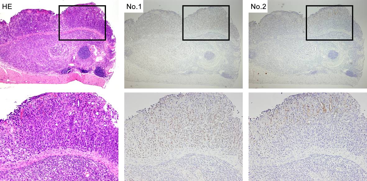 Haematoxylin and eosin (left) and immunohistochemical stainings of serial sections of mouse DGC with antibodies against two proteins (middle and right).
