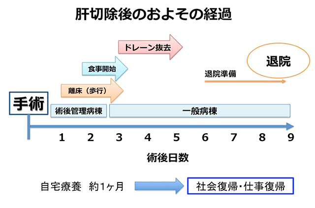 肝切除後のおよその経過