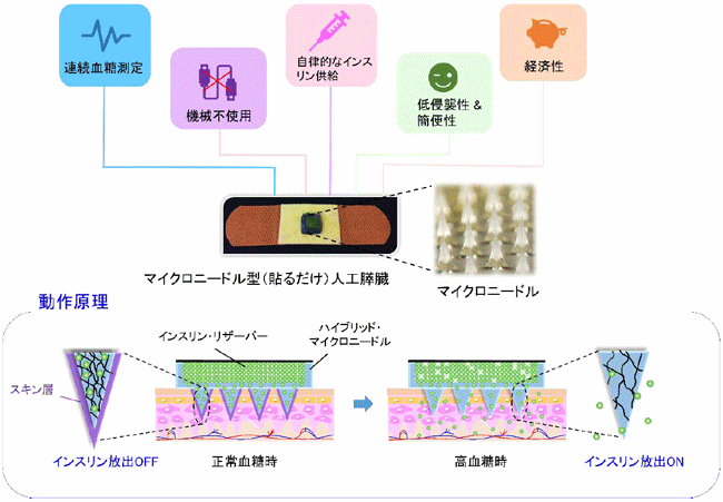 microneedle array