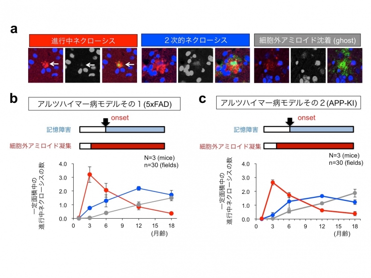 アルツハイマー病の超早期細胞死の解明と新たな治療標的を発見 岡澤均 教授 国立大学法人 東京医科歯科大学