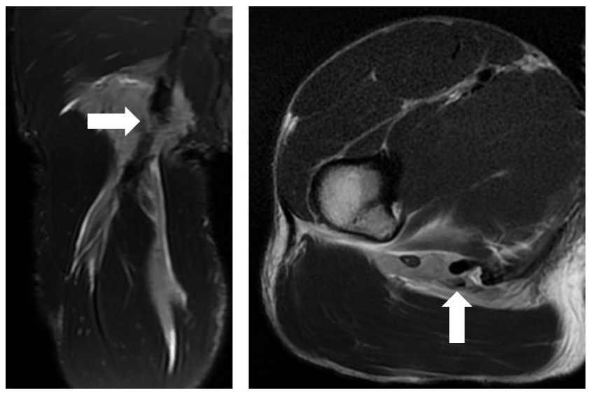 Differences in trunk and lower extremity muscle activity during