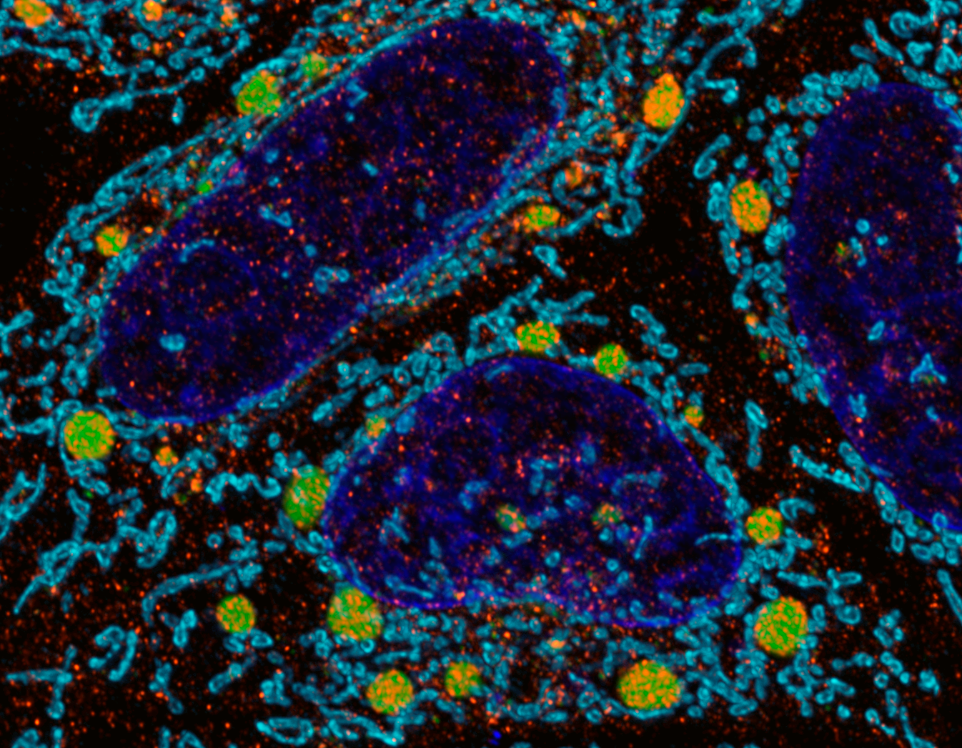 Biomolecula Pathogenesis