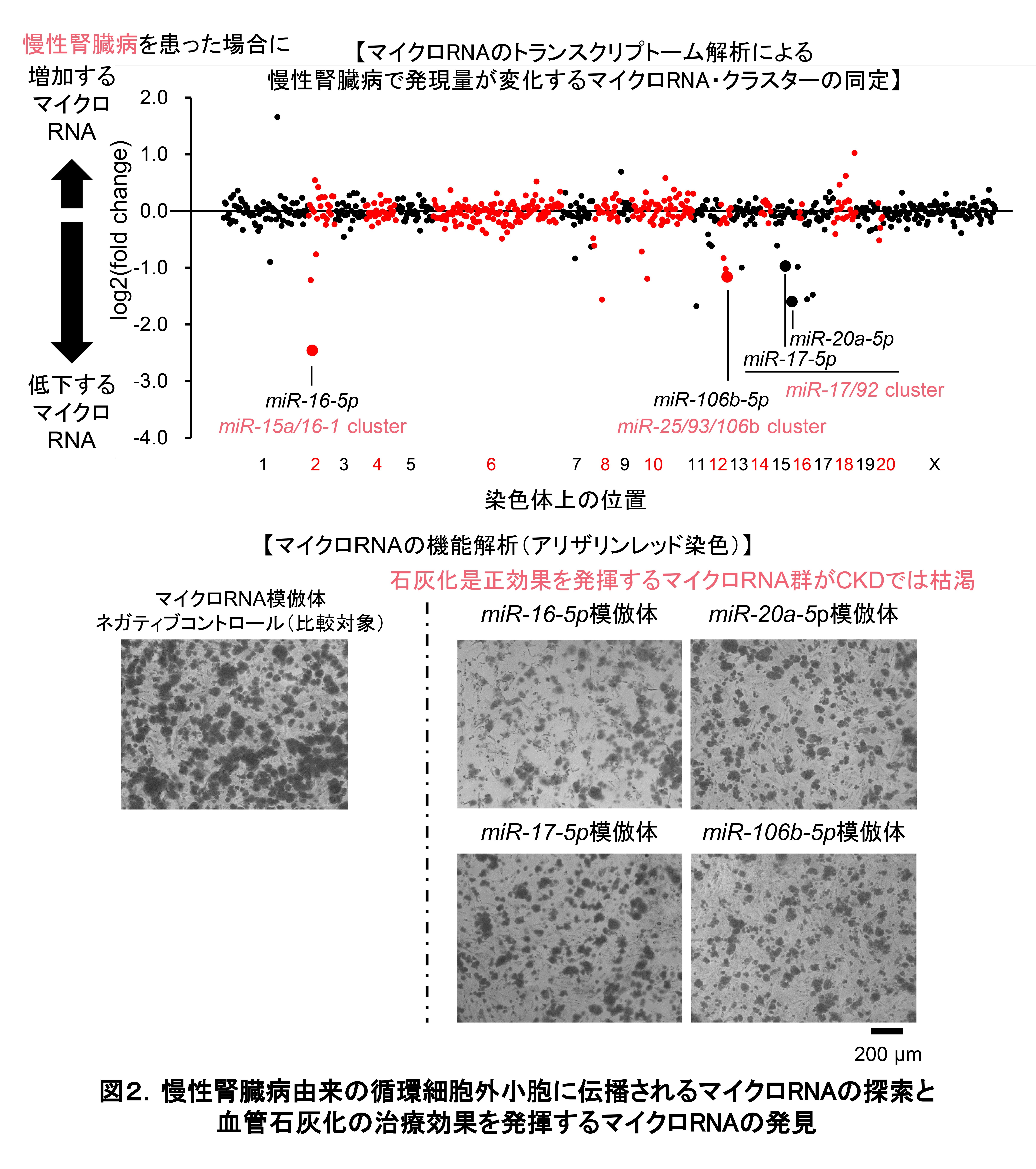 慢性腎臓病において血管石灰化を引き起こす悪玉メッセージ物質を