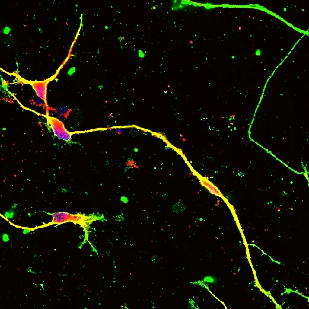 Aav-mediated editing of pmp22 rescues charcot-marie-tooth disease type