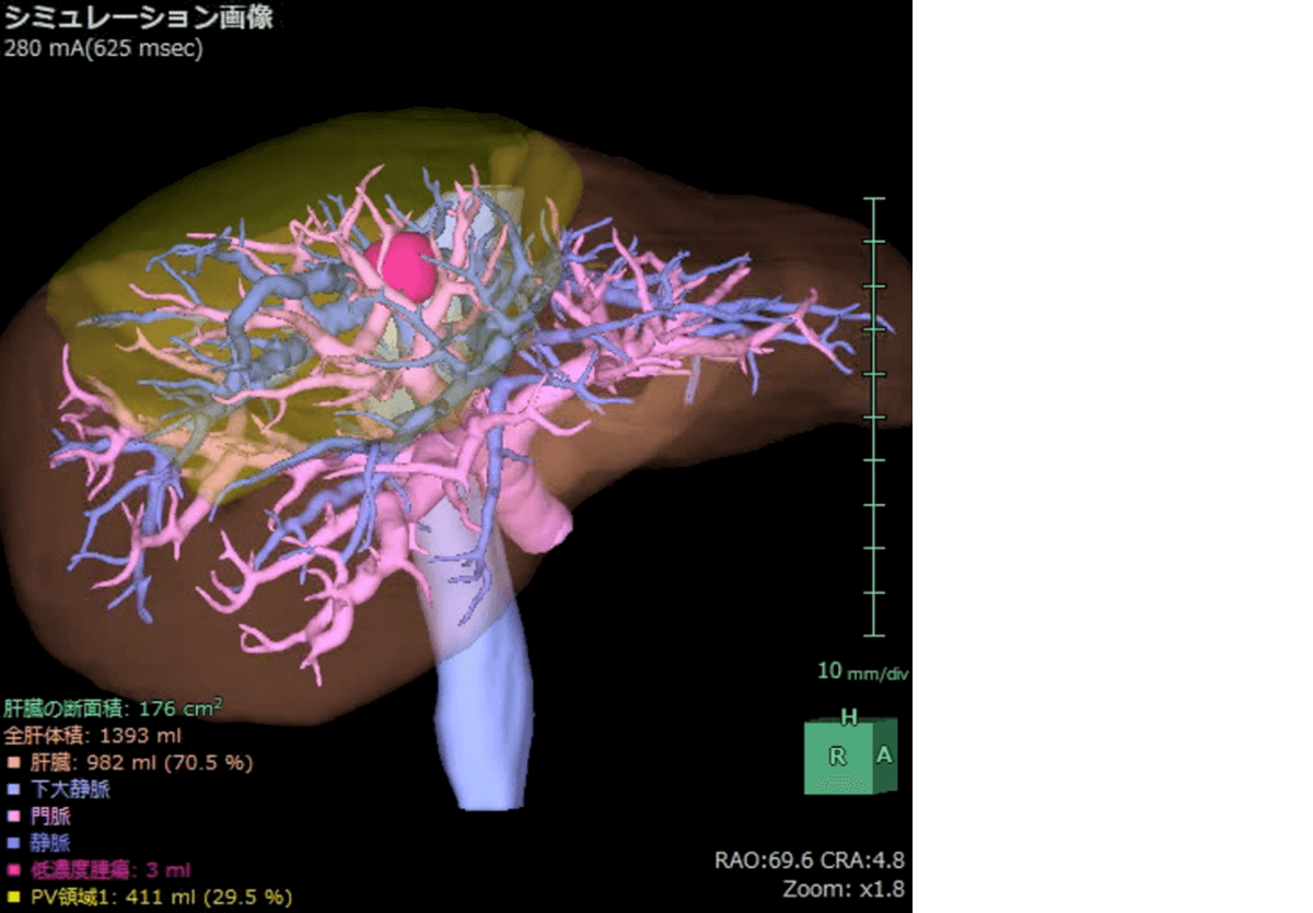 シミュレーション画像