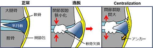 Eɑ΂Centralization@iKoga H, et al. Arthroscopy 2016j