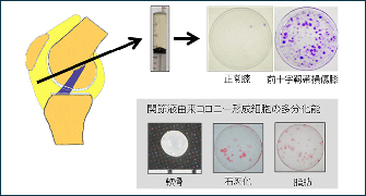 滑膜幹細胞による軟骨再生医療