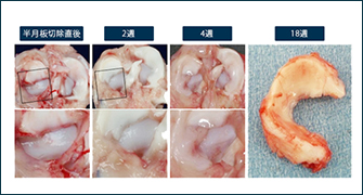 滑膜幹細胞による半月板再生