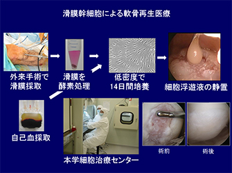 滑膜幹細胞による軟骨再生医療