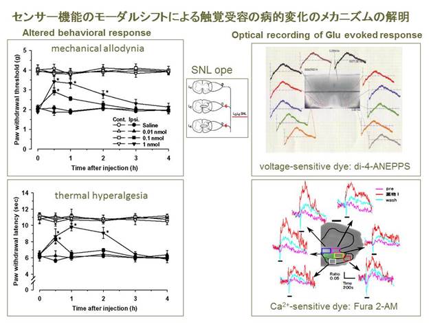 : : D:\new Yakurihomepage\kennkyuu.files\1pain.JPG