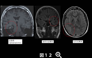 図12