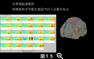 図15