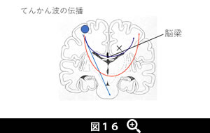 図16