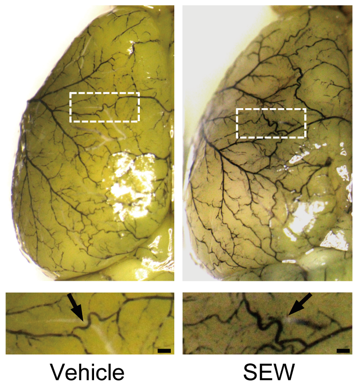 After selective S1PR1 agonist (SEW) administration, leptomeningeal anastomoses are enhanced compared to control (vehicle).