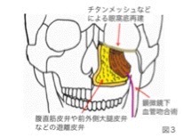 頭頸部再建 - 得意とする分野 | 東京科学大学 形成・美容外科