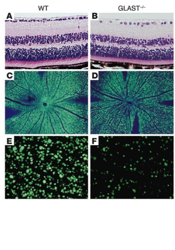 病因論と時間軸で語るＢｉｏｌｏｇｙ－Ｏｒｉｅｎｔｅｄ　Ｄｅｎｔｉｓｔｒｙ メンテ 日本がん対策図鑑 | 【多発性骨髄腫：二次治療（OS